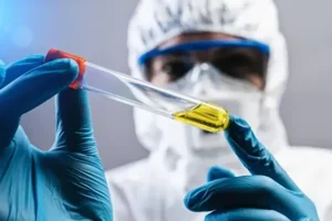 Plague in the 21st Century? Why We Should Talk About the Remnants of Old Threats and the System of Timely Diagnostics