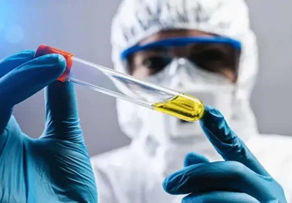 Plague in the 21st Century? Why We Should Talk About the Remnants of Old Threats and the System of Timely Diagnostics
