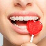 Periodontitis is a chronic inflammation of the tissues that hold the tooth