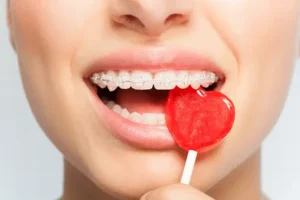 Periodontitis is a chronic inflammation of the tissues that hold the tooth