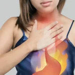Heartburn occurs when acidic stomach contents flow back into the esophagus