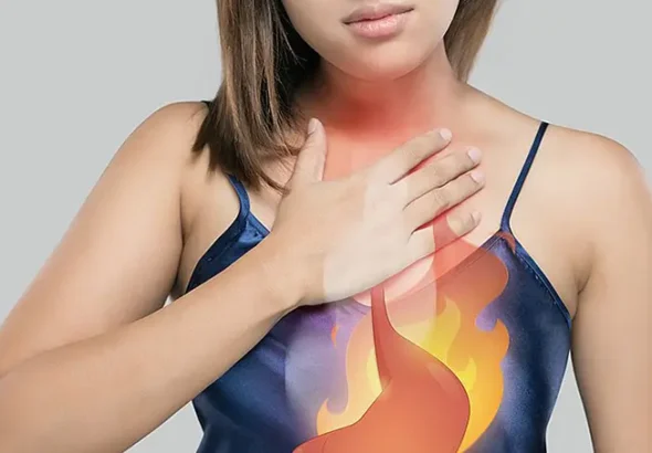 Heartburn occurs when acidic stomach contents flow back into the esophagus