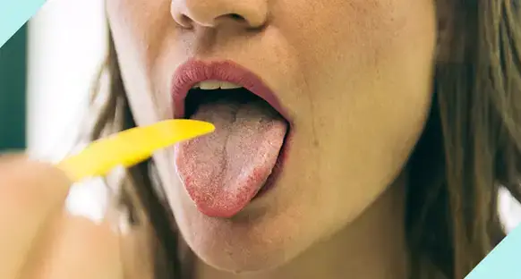 The tongue is a mirror of your digestive system