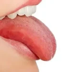 Your tongue is like a mirror for your body. Its color, shape, texture, and even coating can give clues about how your organs