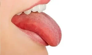 Your tongue is like a mirror for your body. Its color, shape, texture, and even coating can give clues about how your organs