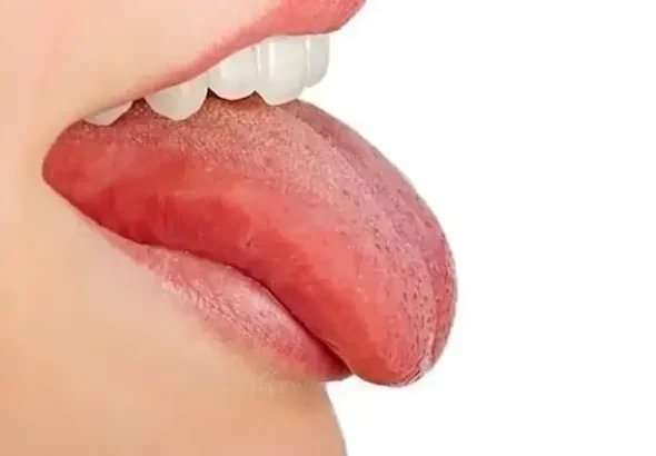 Your tongue is like a mirror for your body. Its color, shape, texture, and even coating can give clues about how your organs