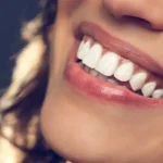 Everyone wants a dazzling smile—especially here in California.