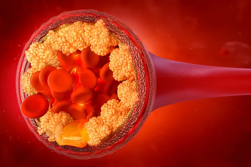 Cholesterol is one of those topics that often creates unnecessary concern